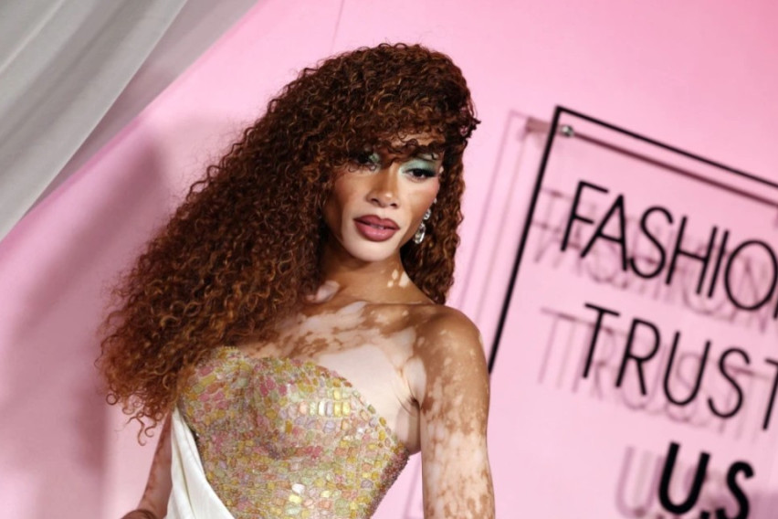 [ФОТО/ВИДЕО] Две бои на кожа, две бои на фустан: Манекенката ги руши стереотипите за убавина